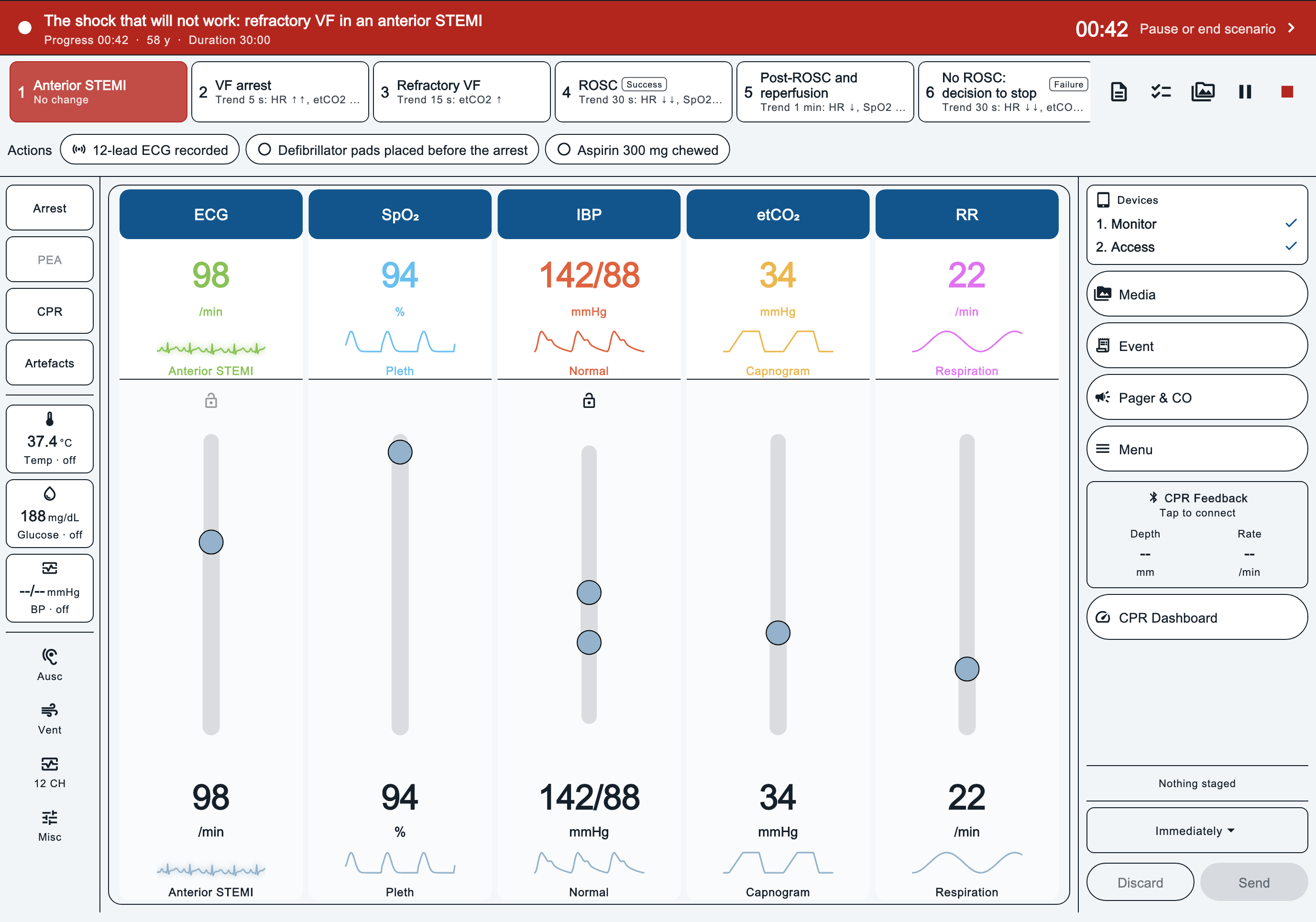 MedControl during a running scenario: phase cards across the top, and sliders for ECG, SpO2, IBP, etCO2 and respiratory rate.