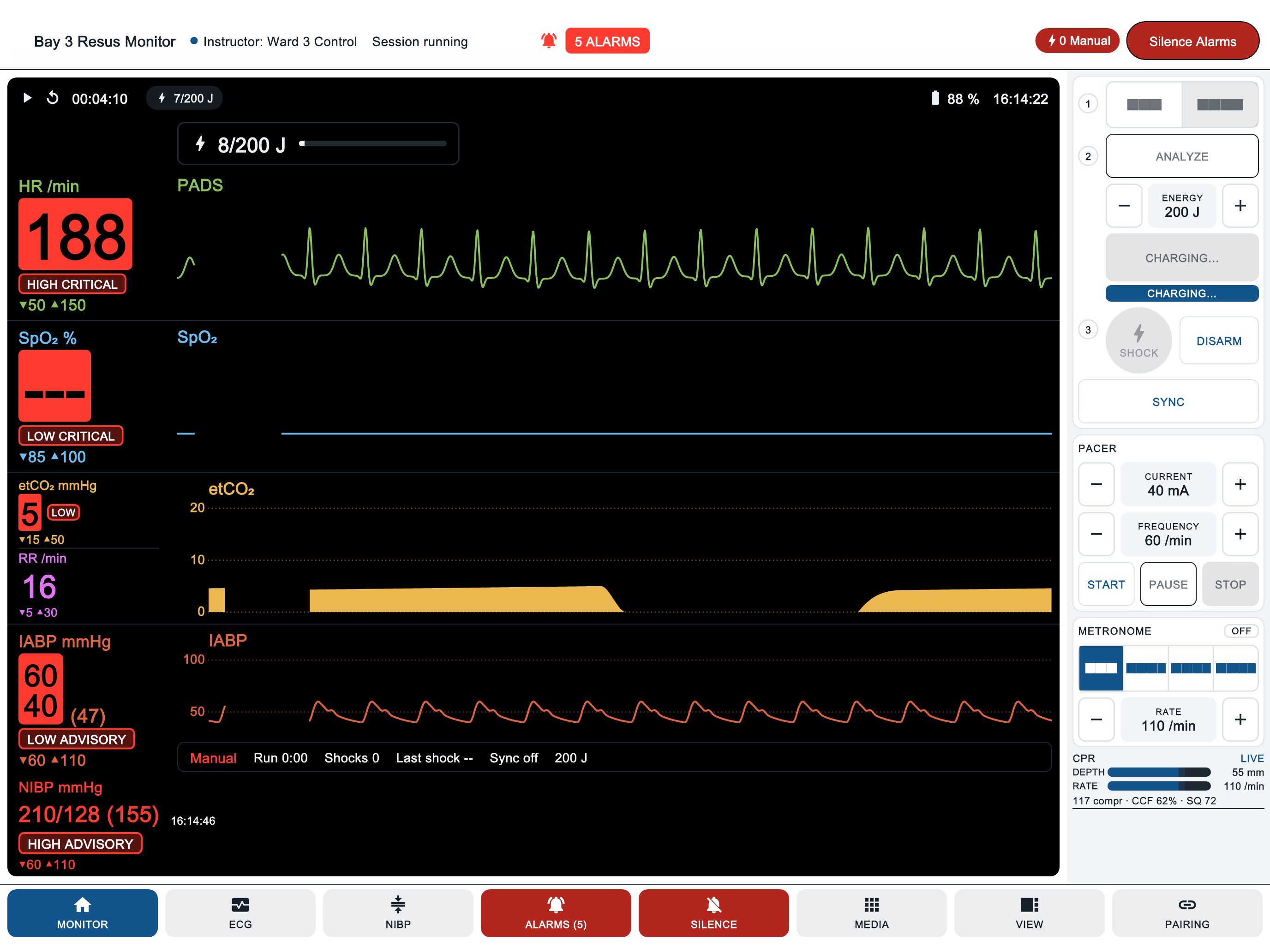 MedMonitor with five active alarms: heart rate 188 high critical, SpO2 low critical, etCO2 low, arterial pressure low and NIBP high, while the defibrillator charges.