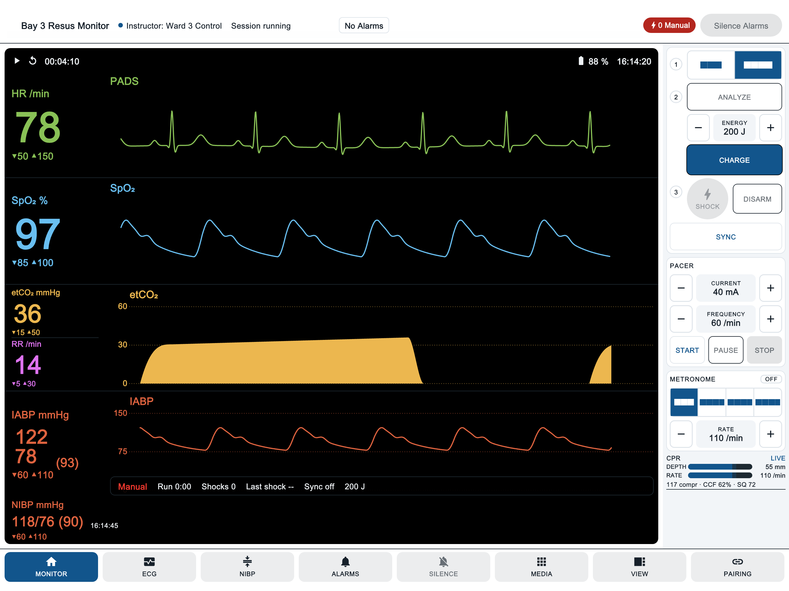 MedMonitor showing heart rate 78, SpO2 97, etCO2 36, respiratory rate 14 and arterial pressure 122 over 78, with the defibrillator and pacer panel on the right.